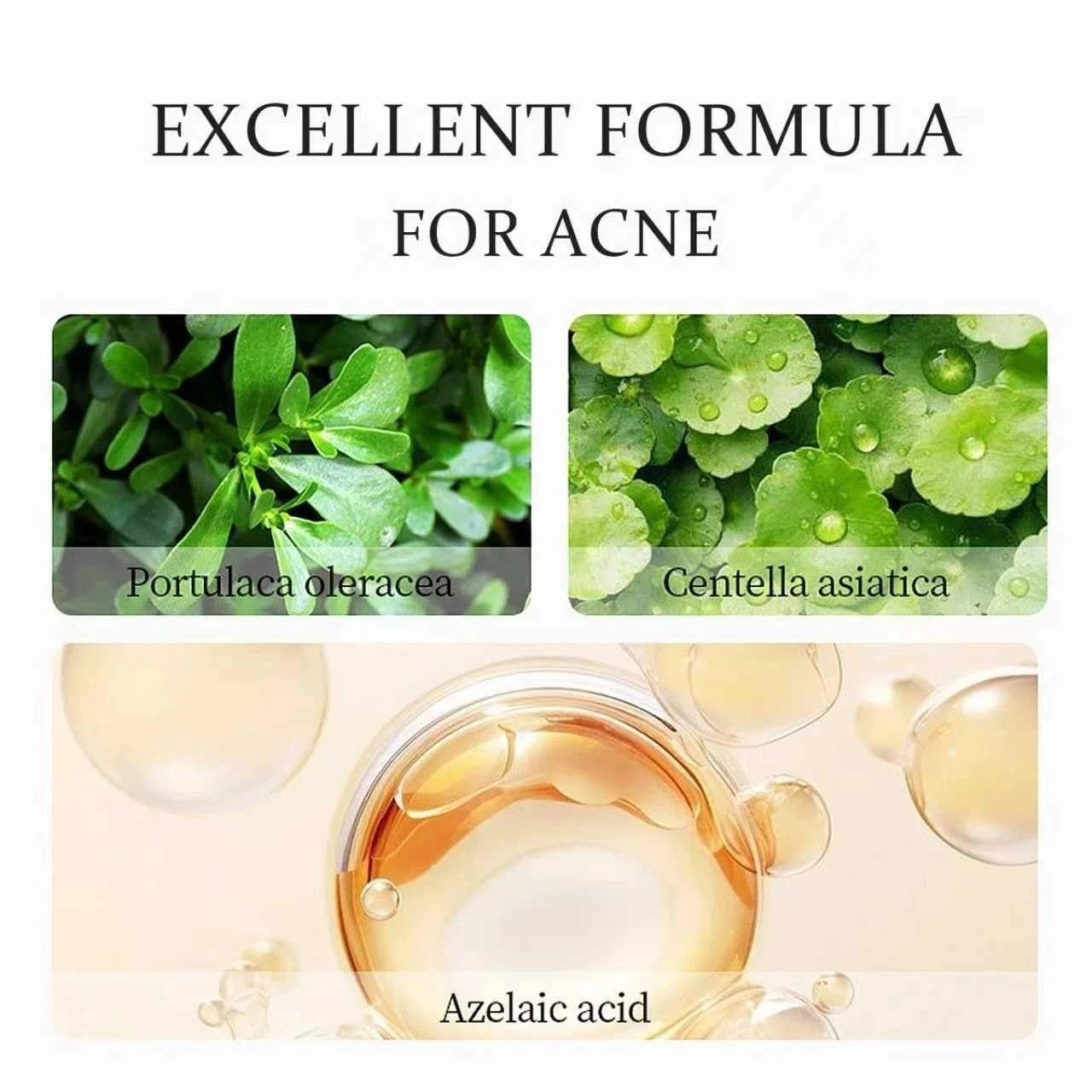 20% Azelaic Acid Cream for Face,Azelaic Acid Moisturize With Hyaluronic Acids fo