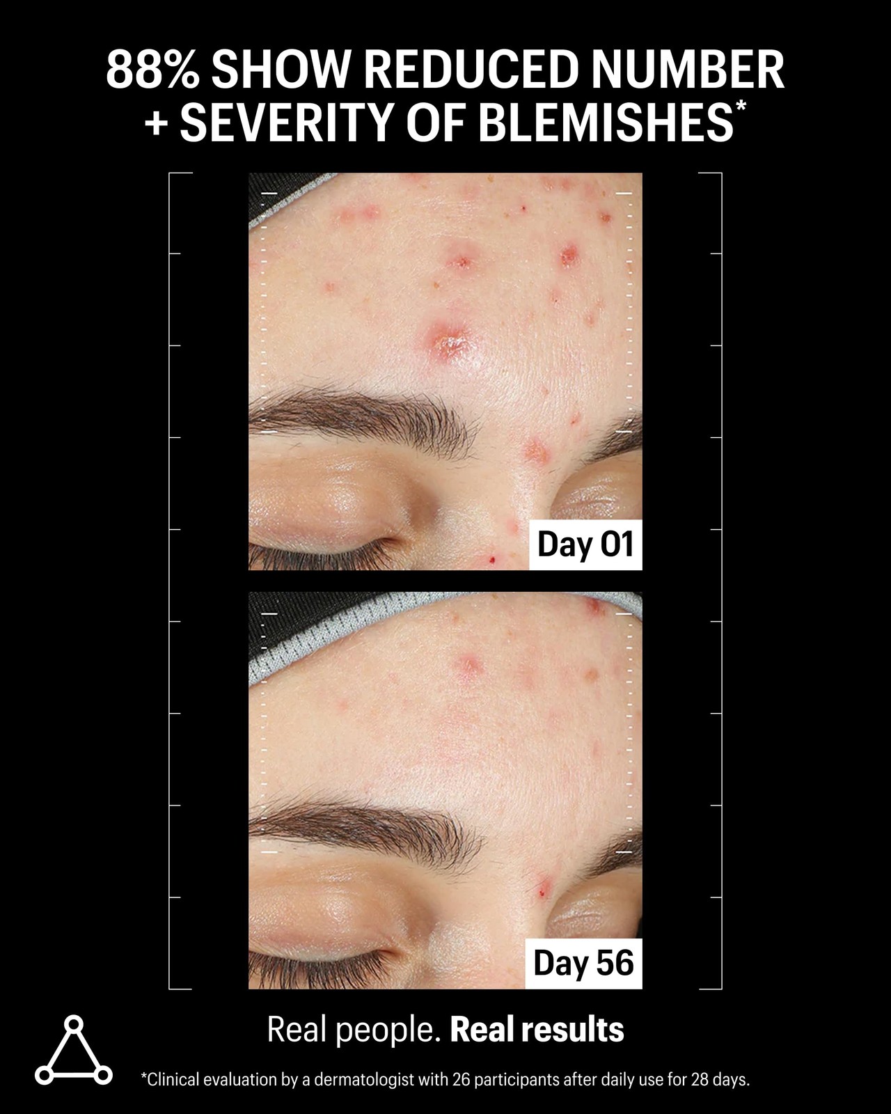 Allies of Skin Azelaic Kojic Clarifying Face Serum | Clinically Proven for A…