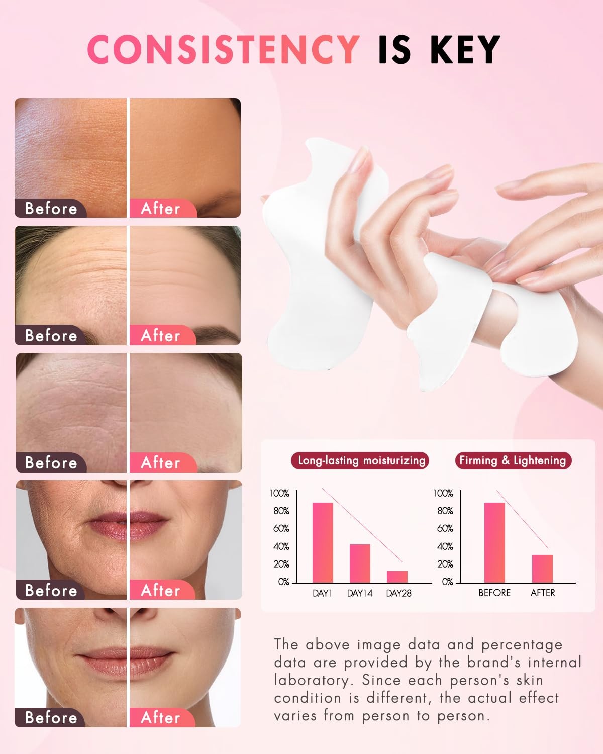 Forehead Smile Line Patches, 36pcs, Hyaluronic Acid, Collagen, Vitamin E