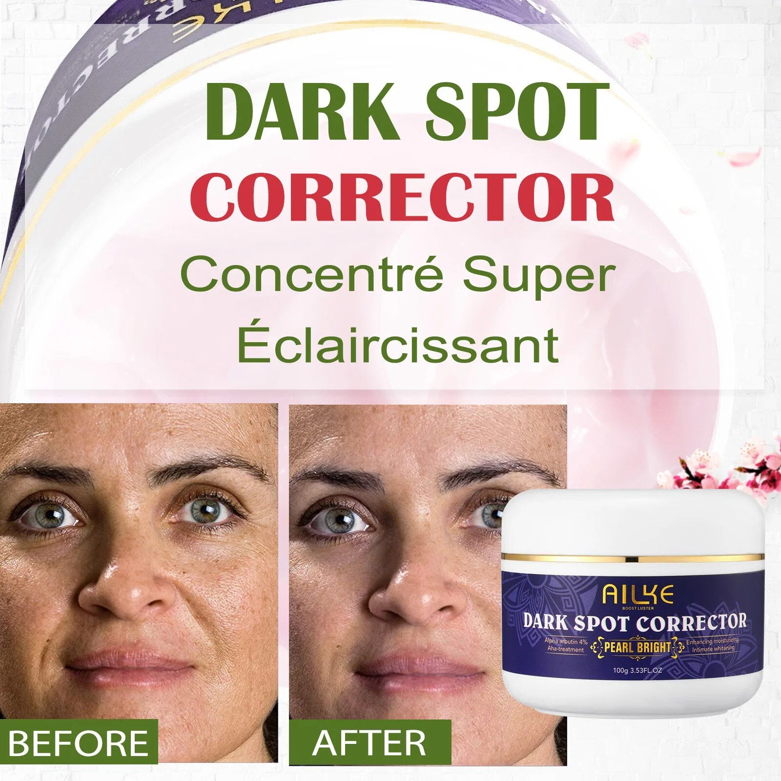 DARK SPOT CORRECTOR for Face Spot Remover USA 100ml/ 3.5 fl oz