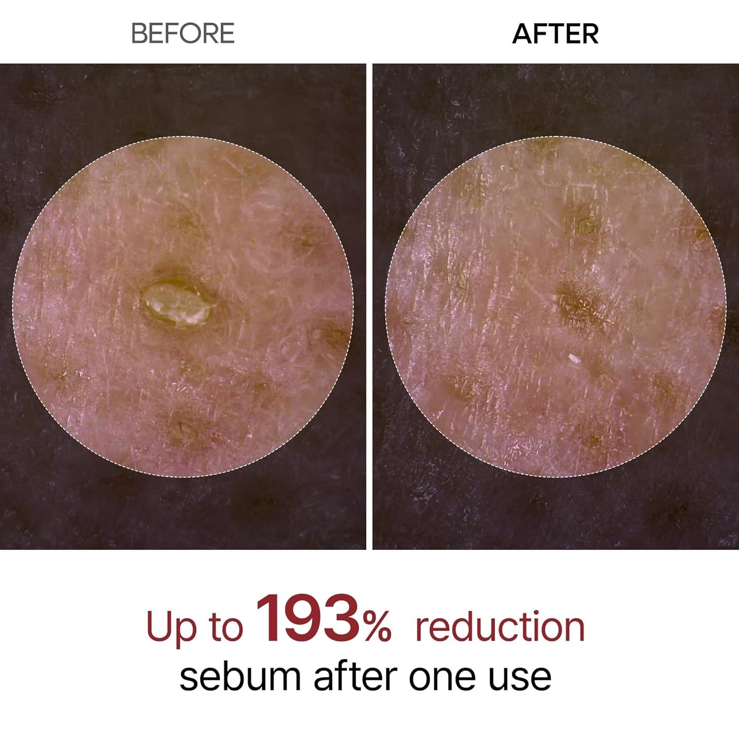 [ Dr.Melaxin ] Peel Shot Glow Black Rice Peeling Ampoule 80ml / 2.7 fl.oz.