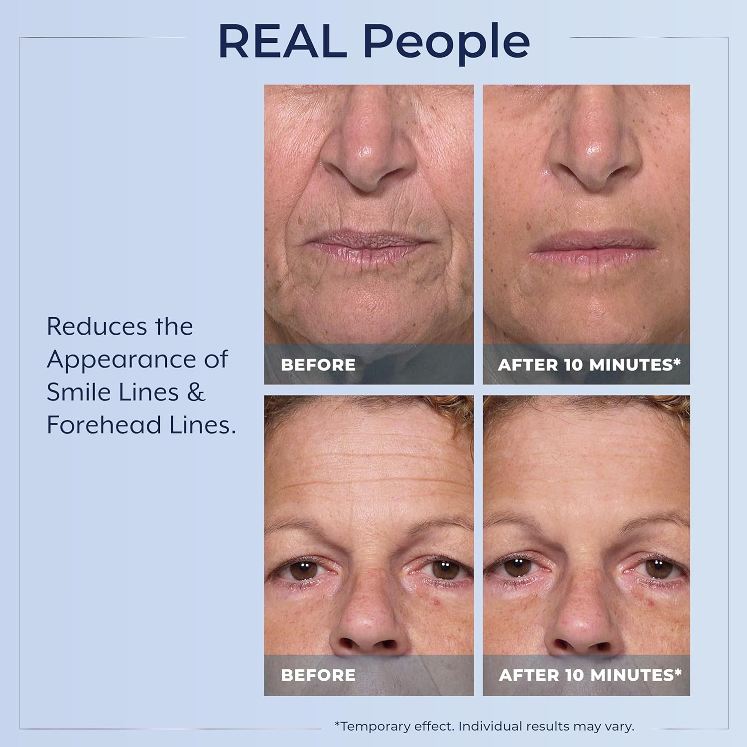 🔥Plexaderm Rapid Reduction Serum 0.33oz Visibly Reduces Under-Eye Bags,Wrinkles