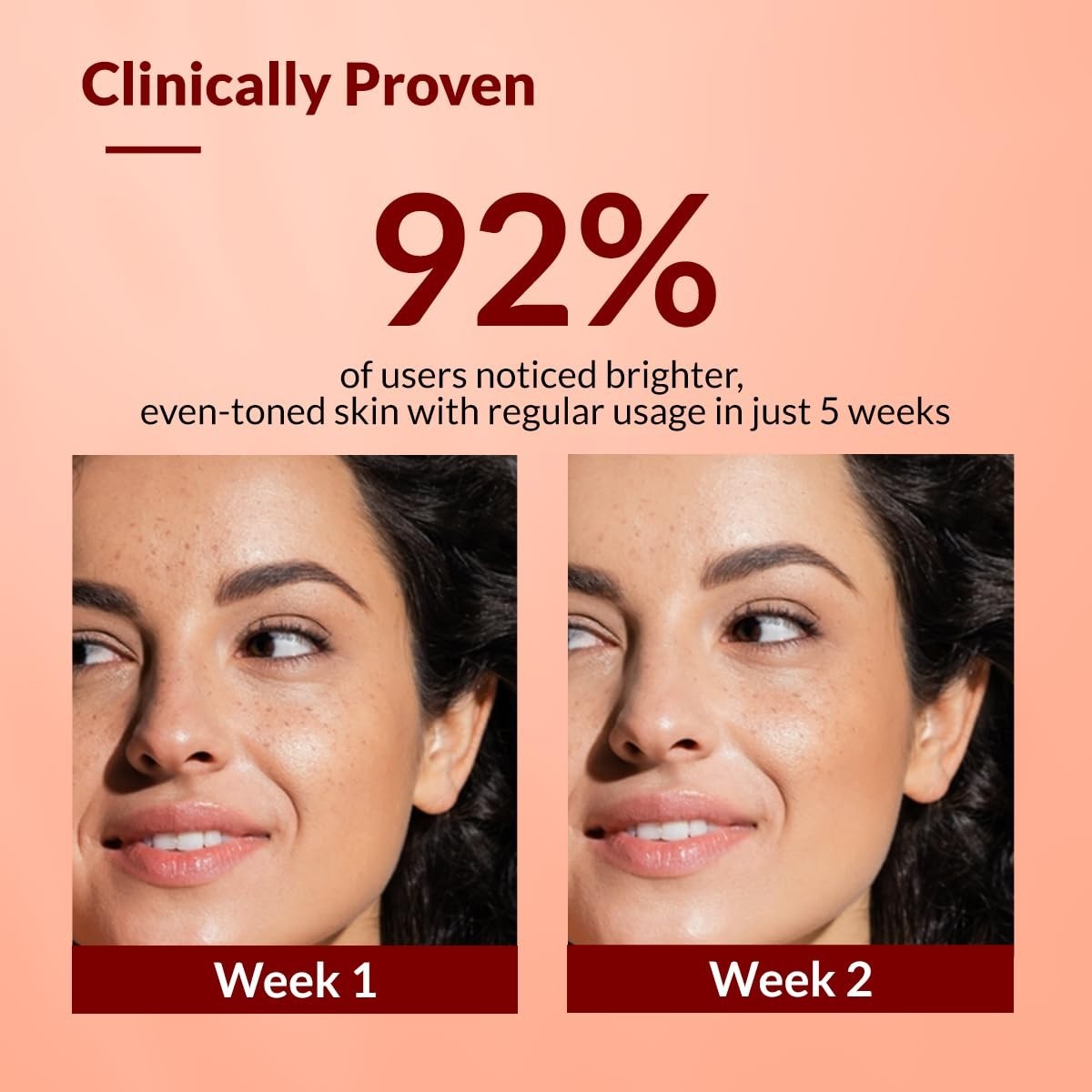 Fixderma Tranexamic Acid + 2%Kojic Acid + 1%Arbutin SKARFIX TX Face Cream (30 g)