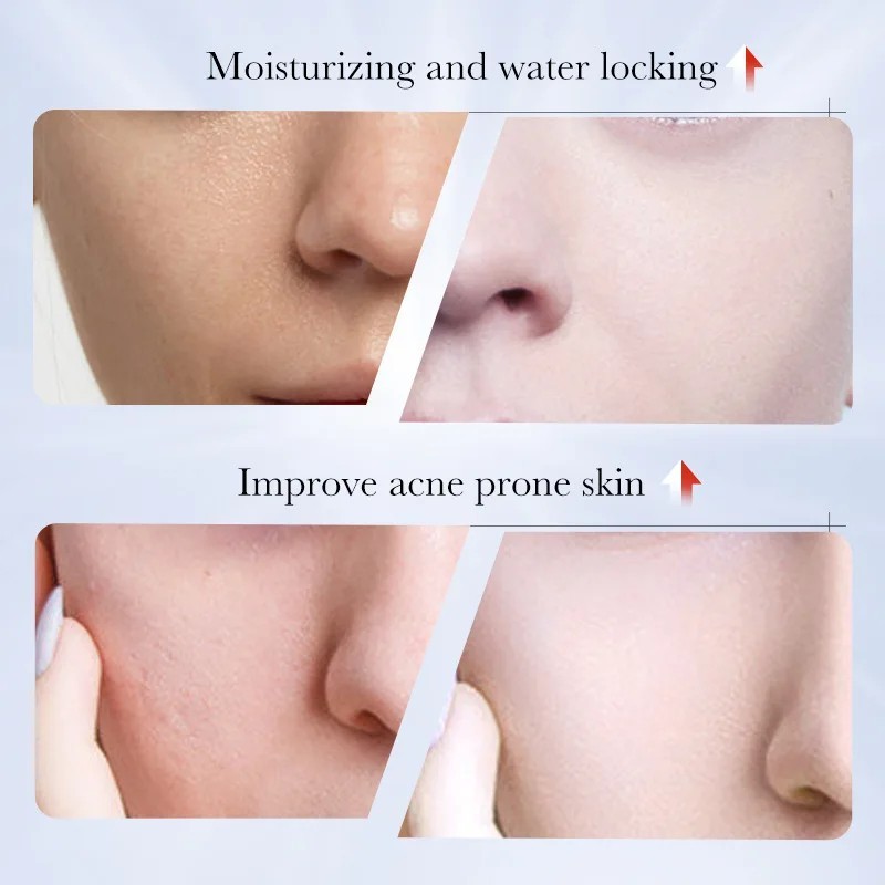 SADOER Kojic Acid Skin Care Set – Freckle Removal & Moisturizing Travel Kit