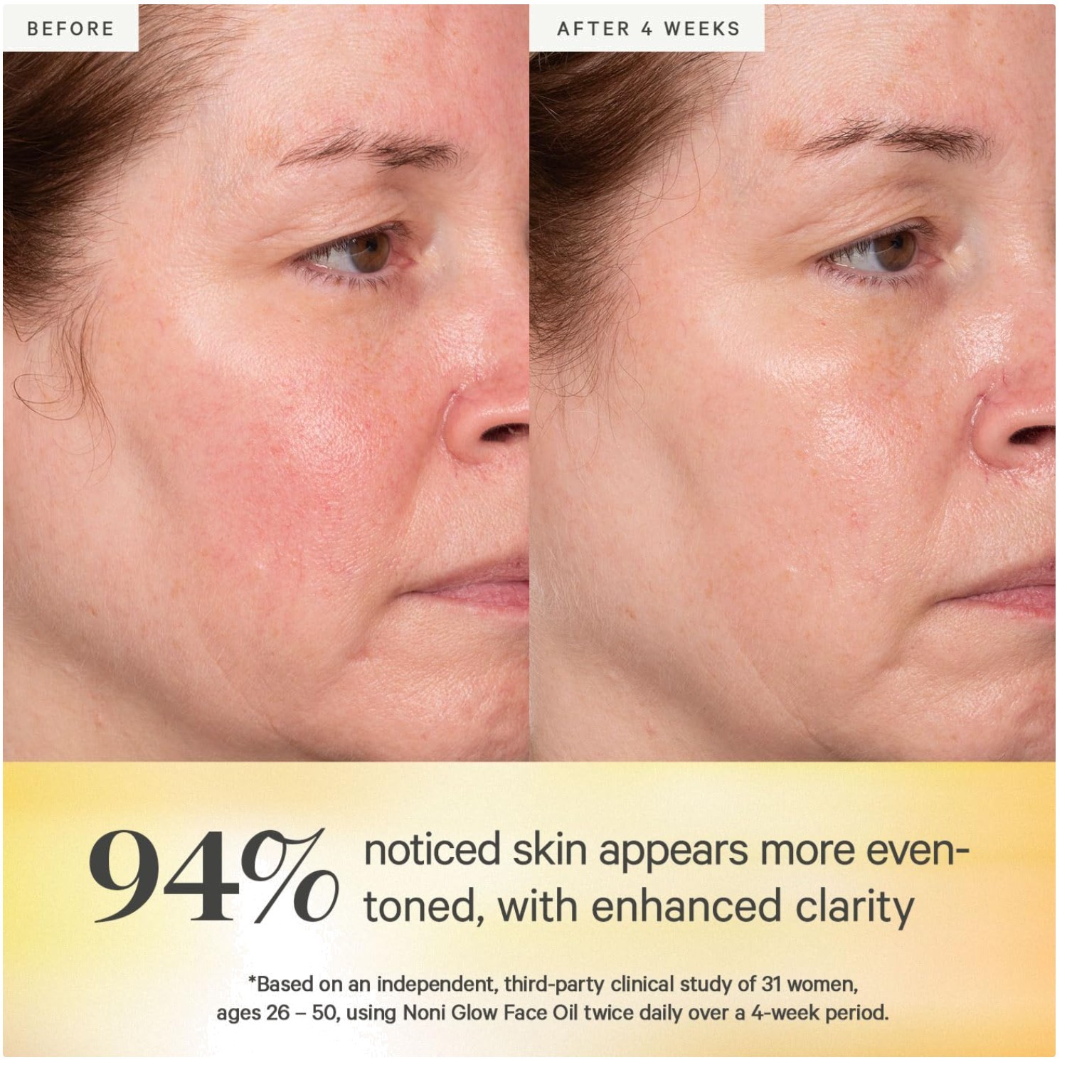 Lightweight Facial Oil for Radiant Skin – Rosehip & Jojoba^