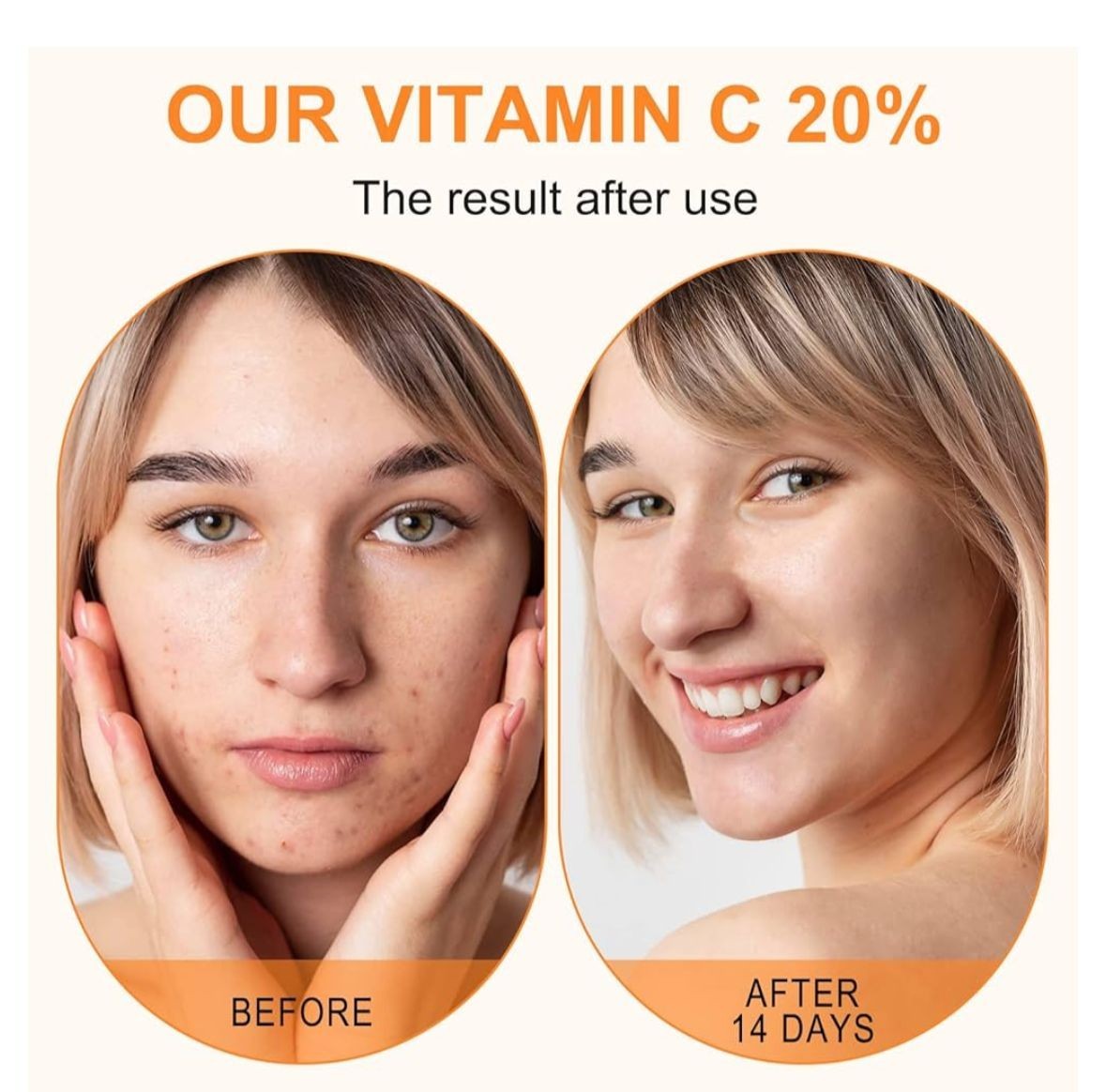 Premium 20% Vitamin C Serum For Face with Hyaluronic Acid, Retinol & Amino Acids