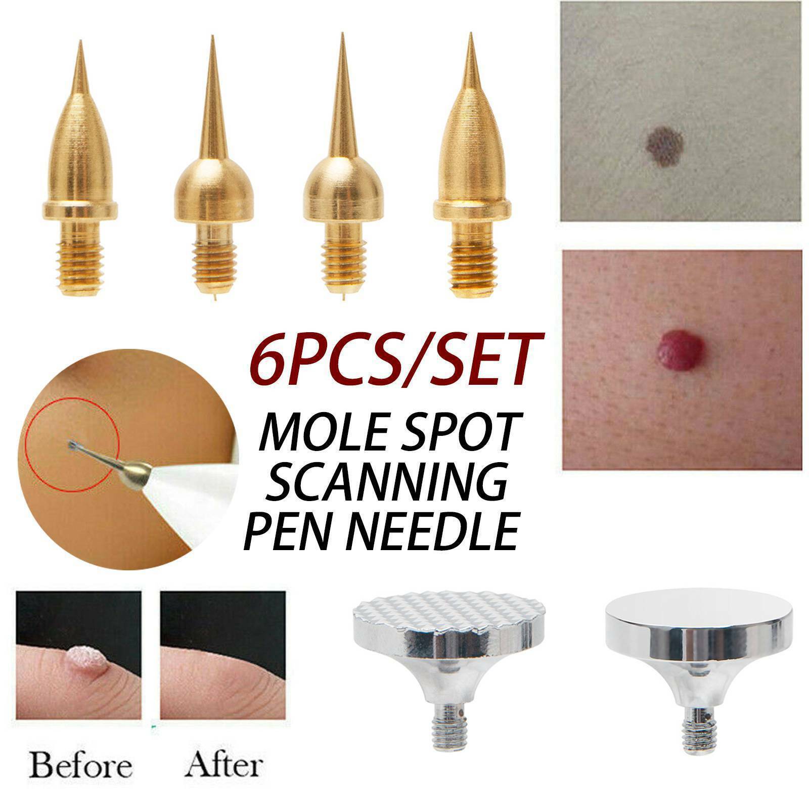 6Pcs/set Beauty Monster Fibroblast Plasma Pen Spot M0le Tattoo Removal PenNe*dle