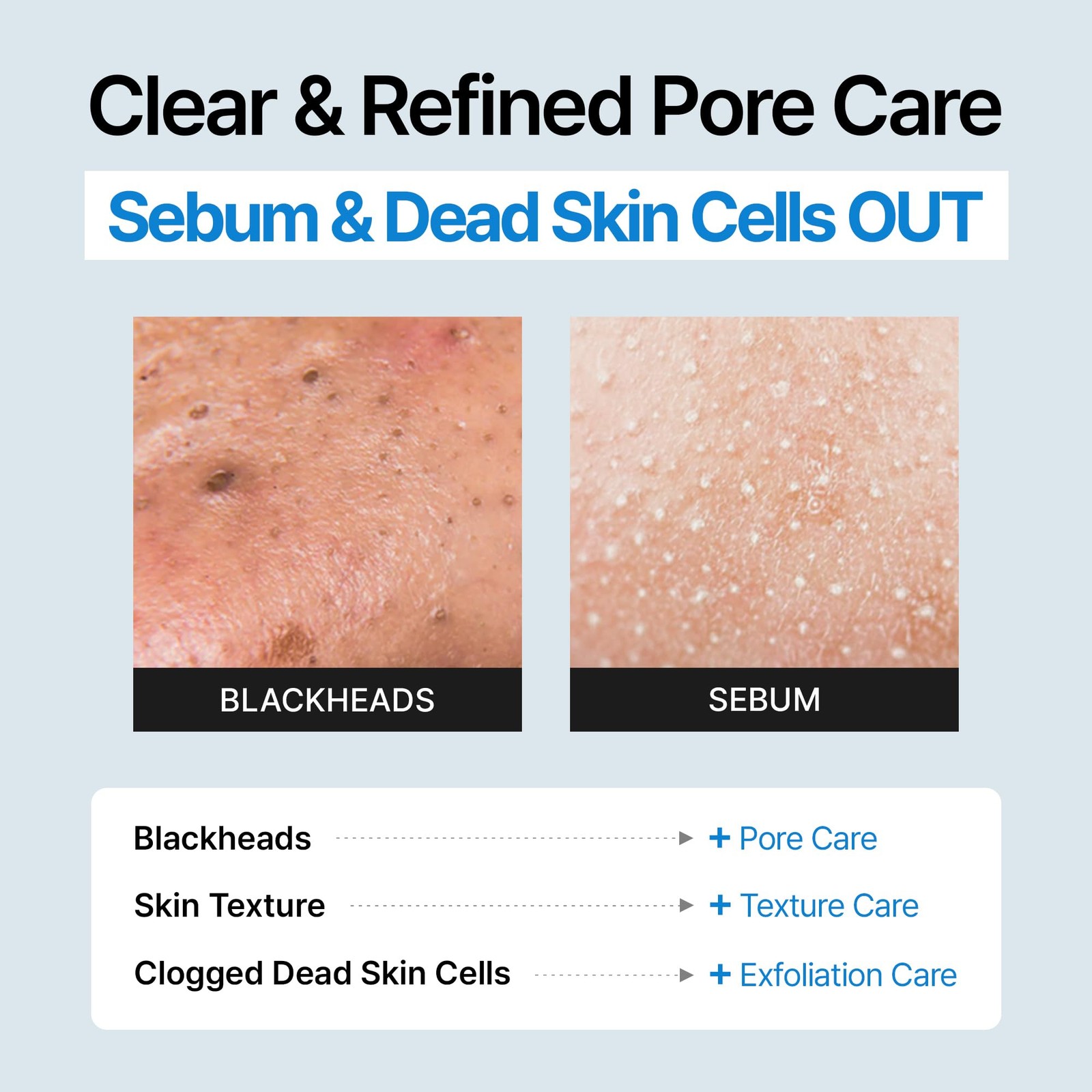 Sebum Melting Solution with Cotton Pads (50 Count) & Pore Extractor Tool – Bl…