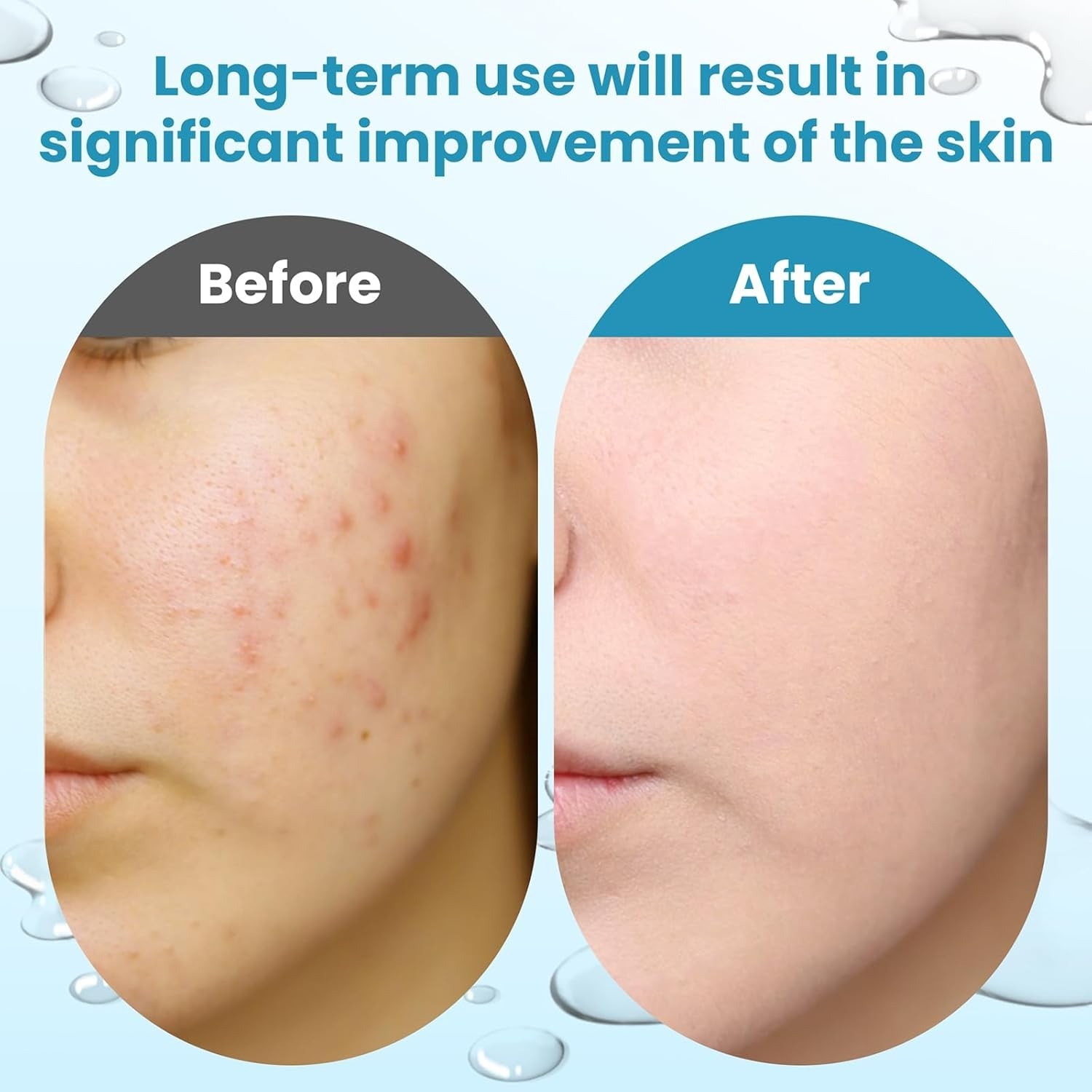Glycolic Acid Resurfacing Pads, 15% Ultra Pure Glycolic Acid & 2% Salicylic Acid