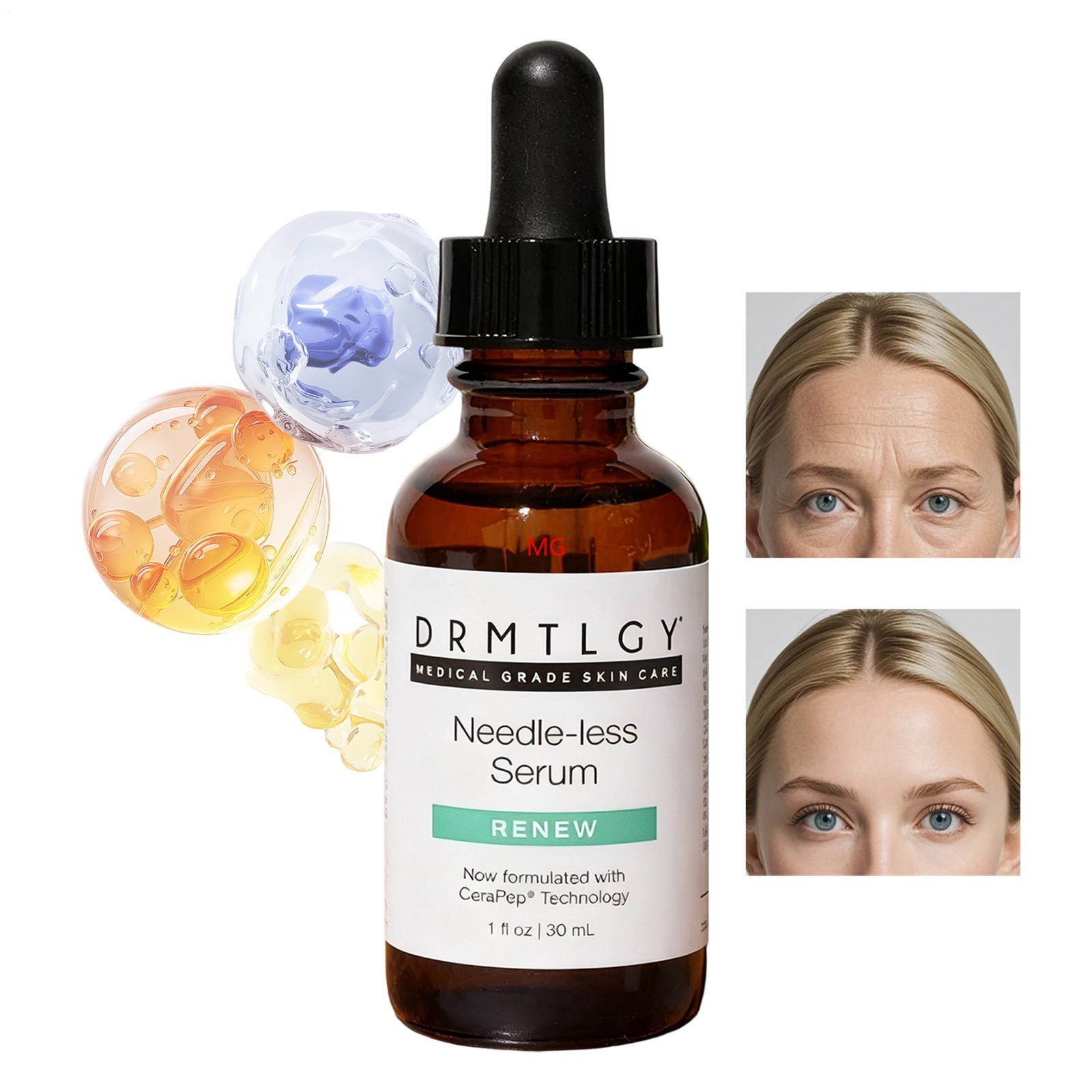 DRMTLGY Needle-Less Serum Renew 30ml 1.0oz Anti-Aging Treatment NWOB