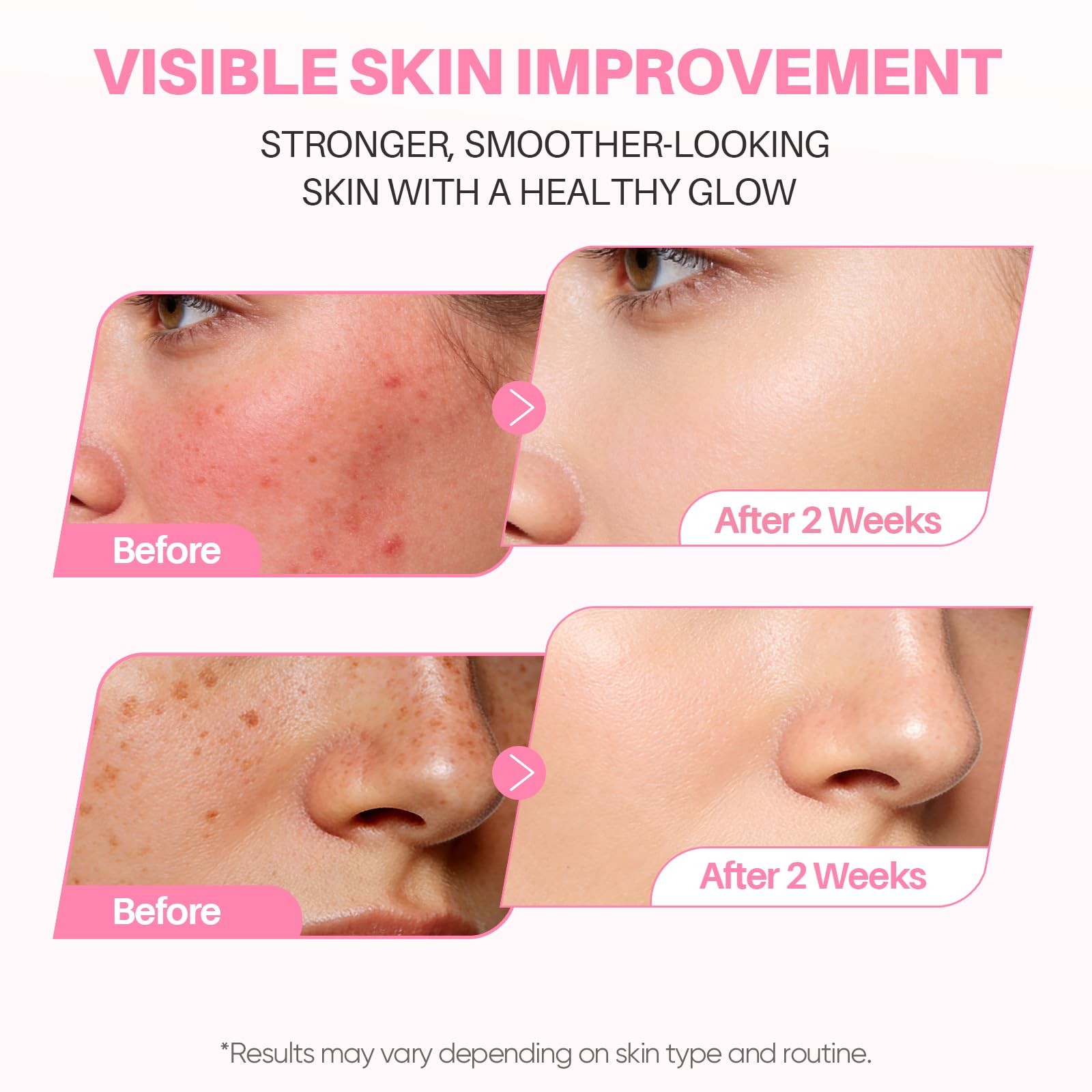 PDRN Pink Serum with 10000ppm Salmon DNA, Niacinamide Serum and Multi Peptide…