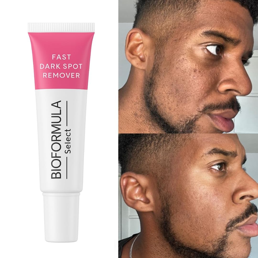 The Fast Dark Spot Remover
