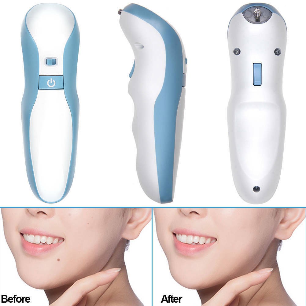 New Plasma pen with cartridge eyelid lift fibroblast tightening skin resurfacing