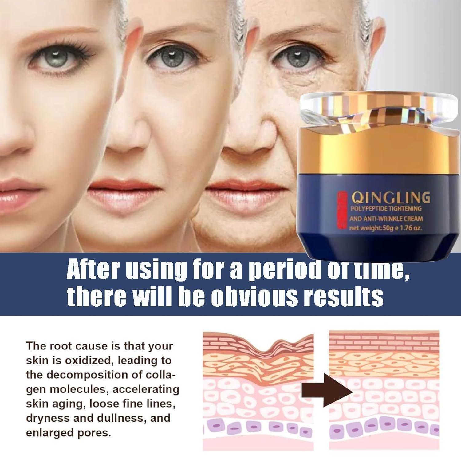 Qingling Crema Para Arrugas, Qingling Face Cream, Qingling Wrinkle Removal Cream