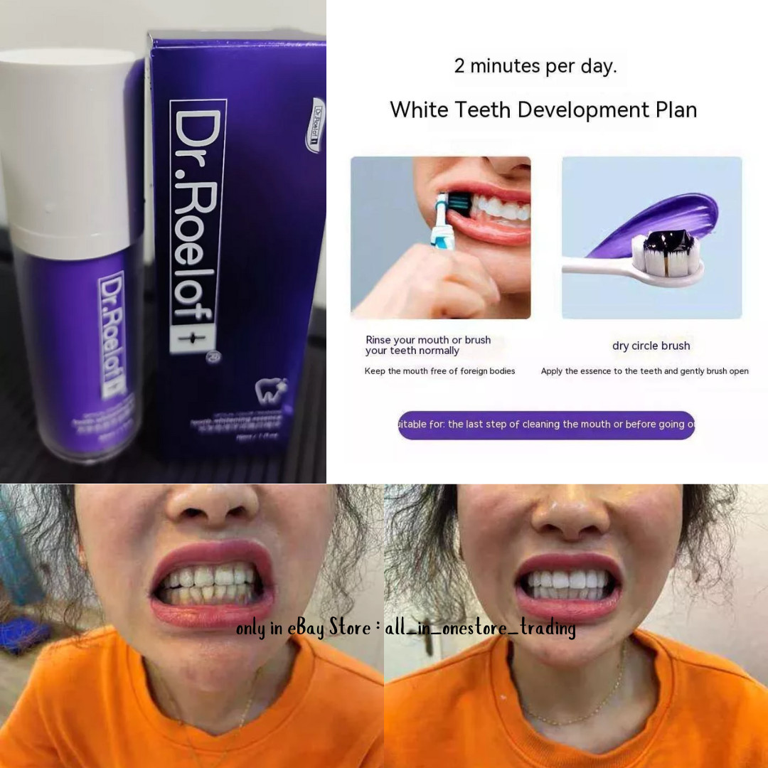 Dr.Roelof Tooth-Whitening-Essence-Freshens-Breath Clean Teeth (EXP2026) 30ml