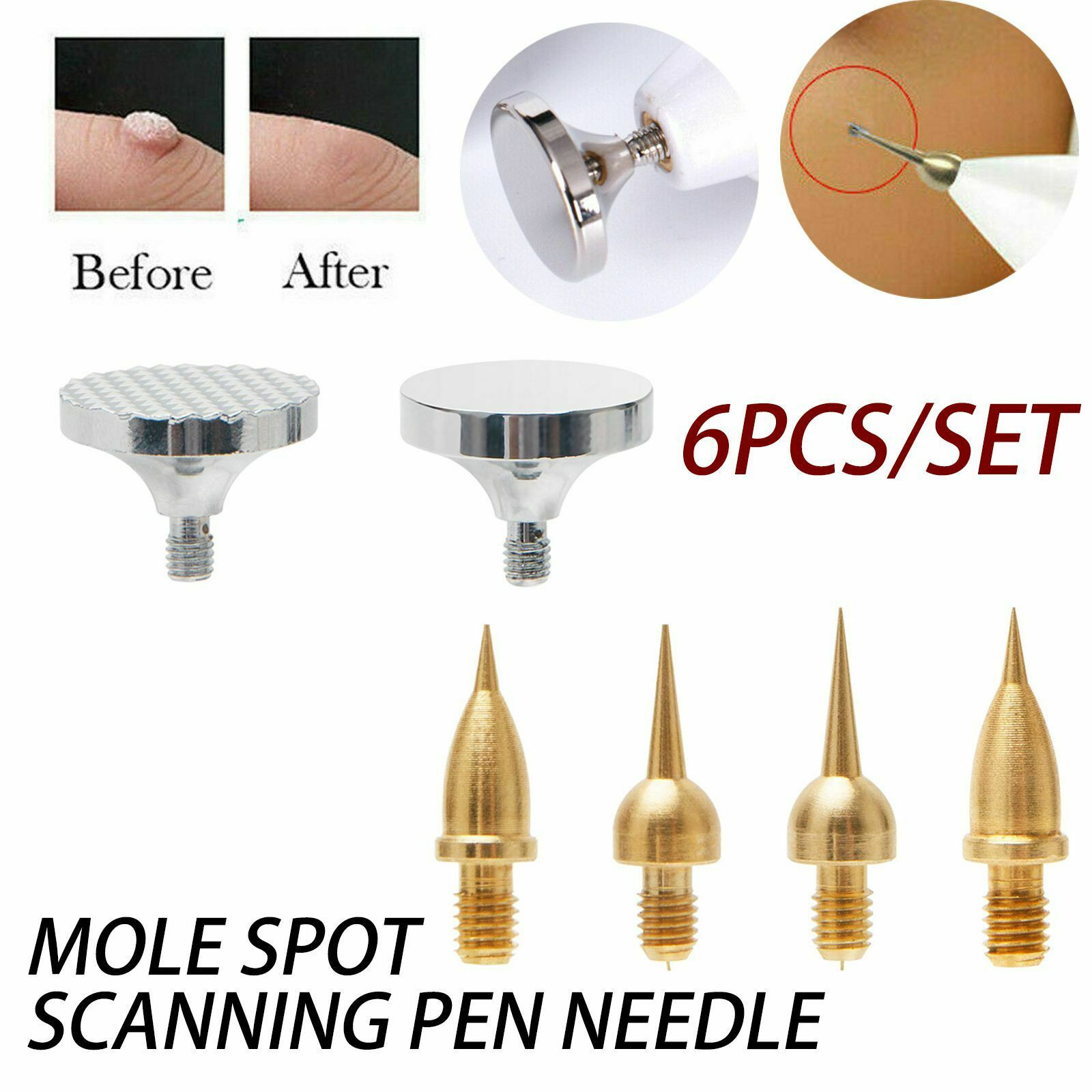 4X Fine Tip+1X Fractional+Permeating Tips 6pcs/Set For Beauty Monster Plasma Pen