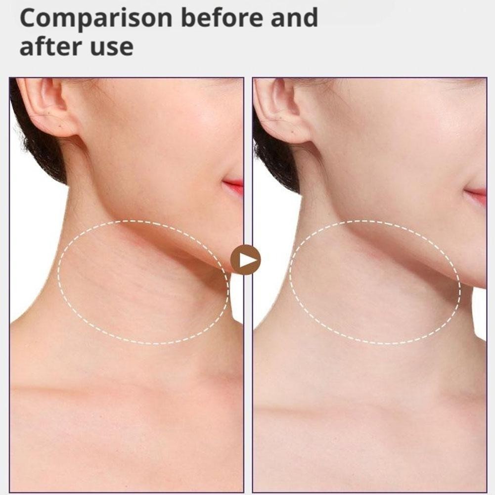 4Pcs Women’s Invisible Neck Lifter Bandage,20PCS Neck Wrinkle Removal Stic