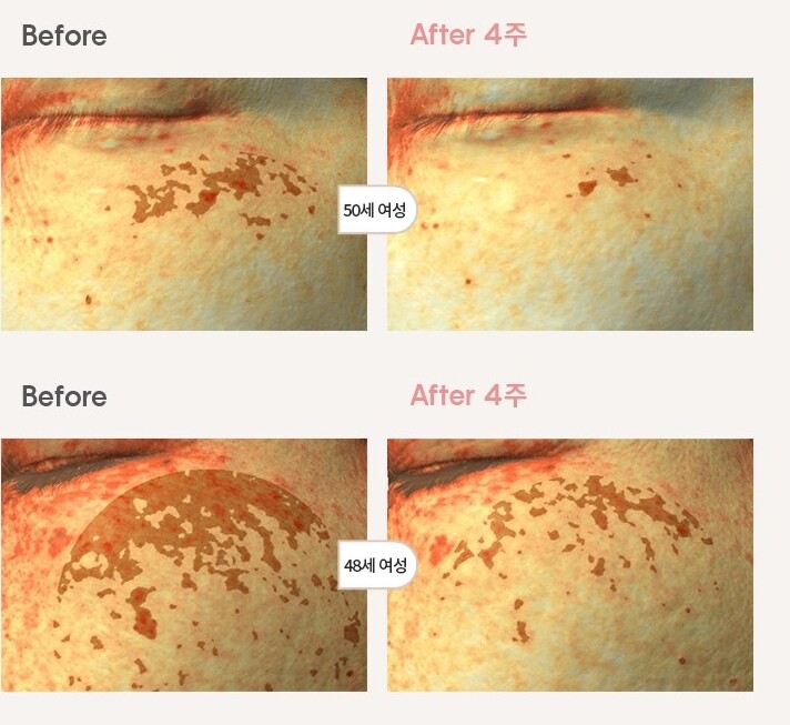 AHC H Mela Root Cream Dark Spots Melasma Care Korean Skin Care K-Beauty NEW