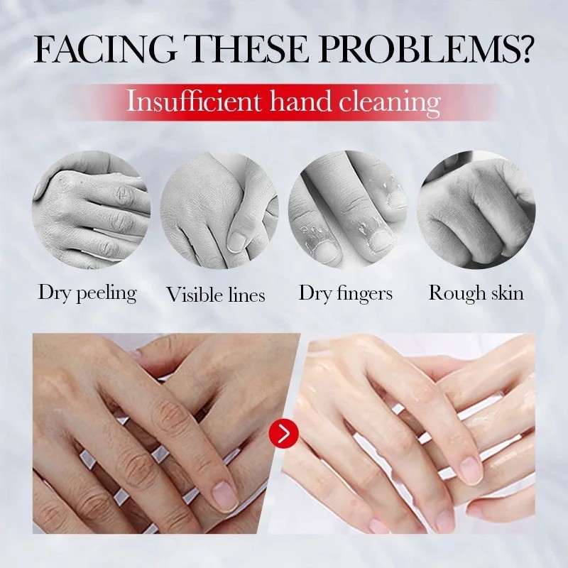 SADOER Kojic Acid Hand Cream Moisturizing Brightening Skin Care