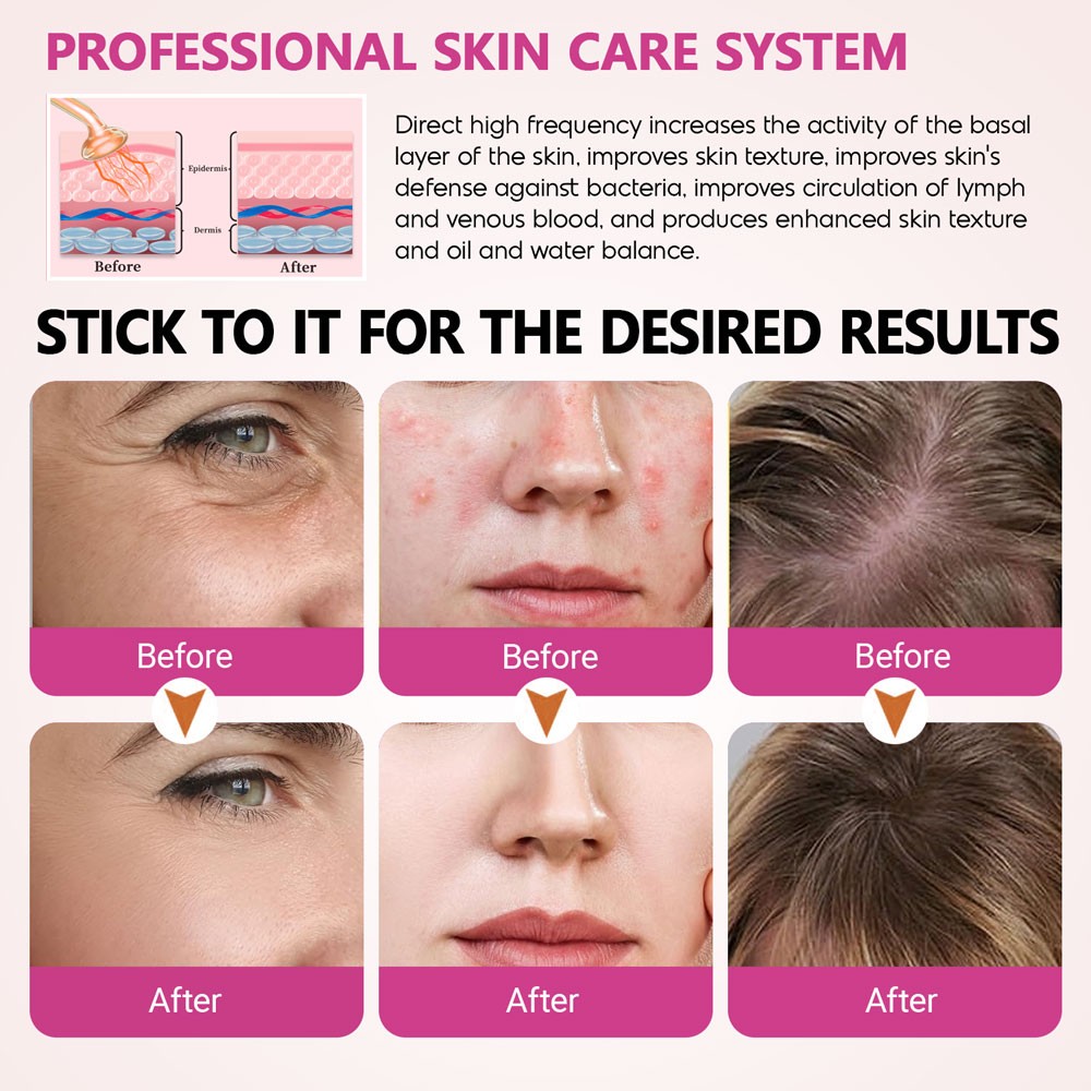 High Frequency Facial Wand- Portable Handheld High Frequency Facial Machine Skin