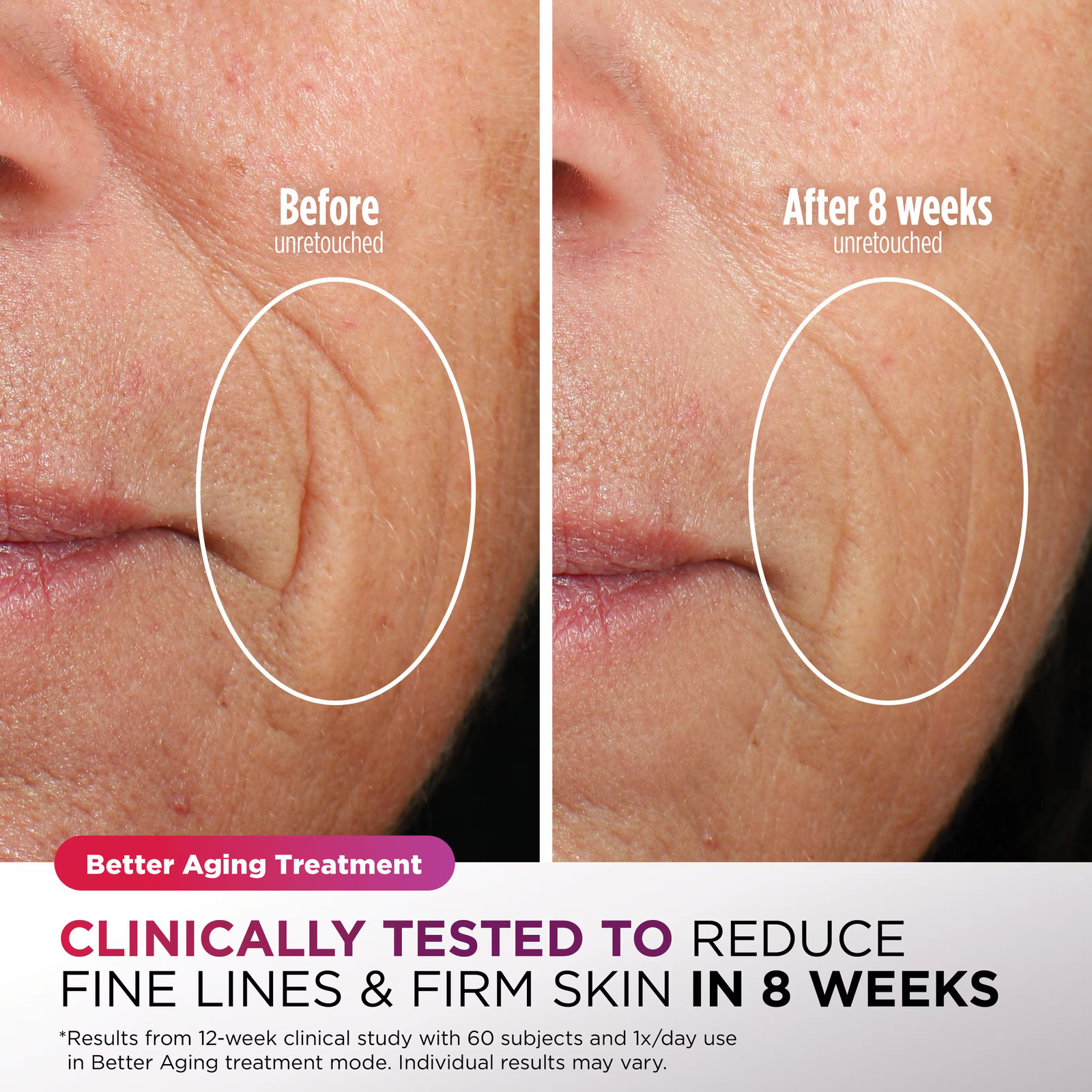 Shark – CryoGlow Under- Eye Cooling + LED Anti-Aging & Skin Clearing Face Mas…