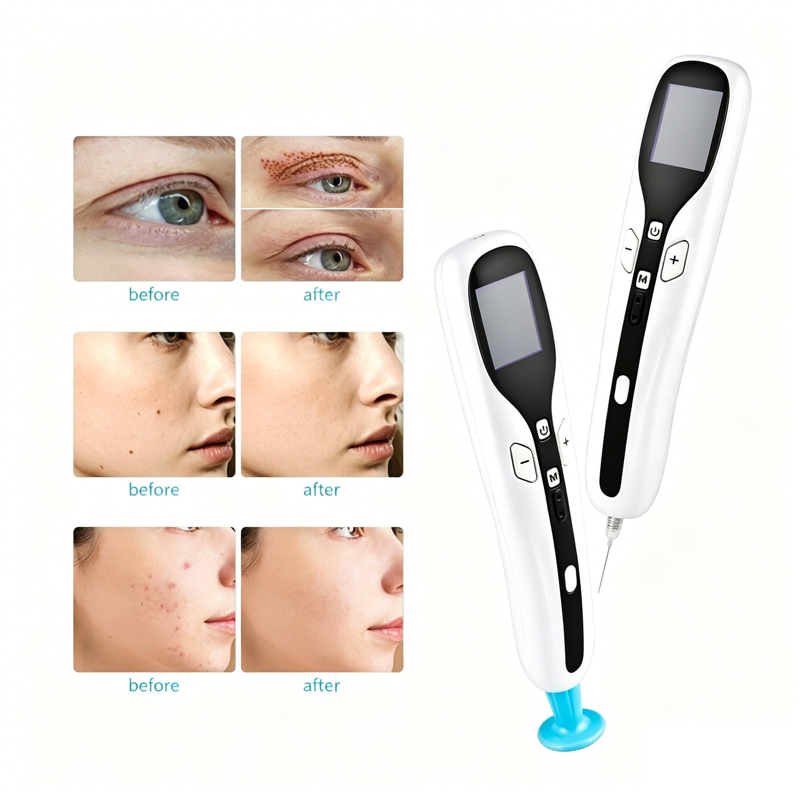 New USB Rechargeable Plasma Beauty Pen with Multiple Tips for Spot Cleaner US