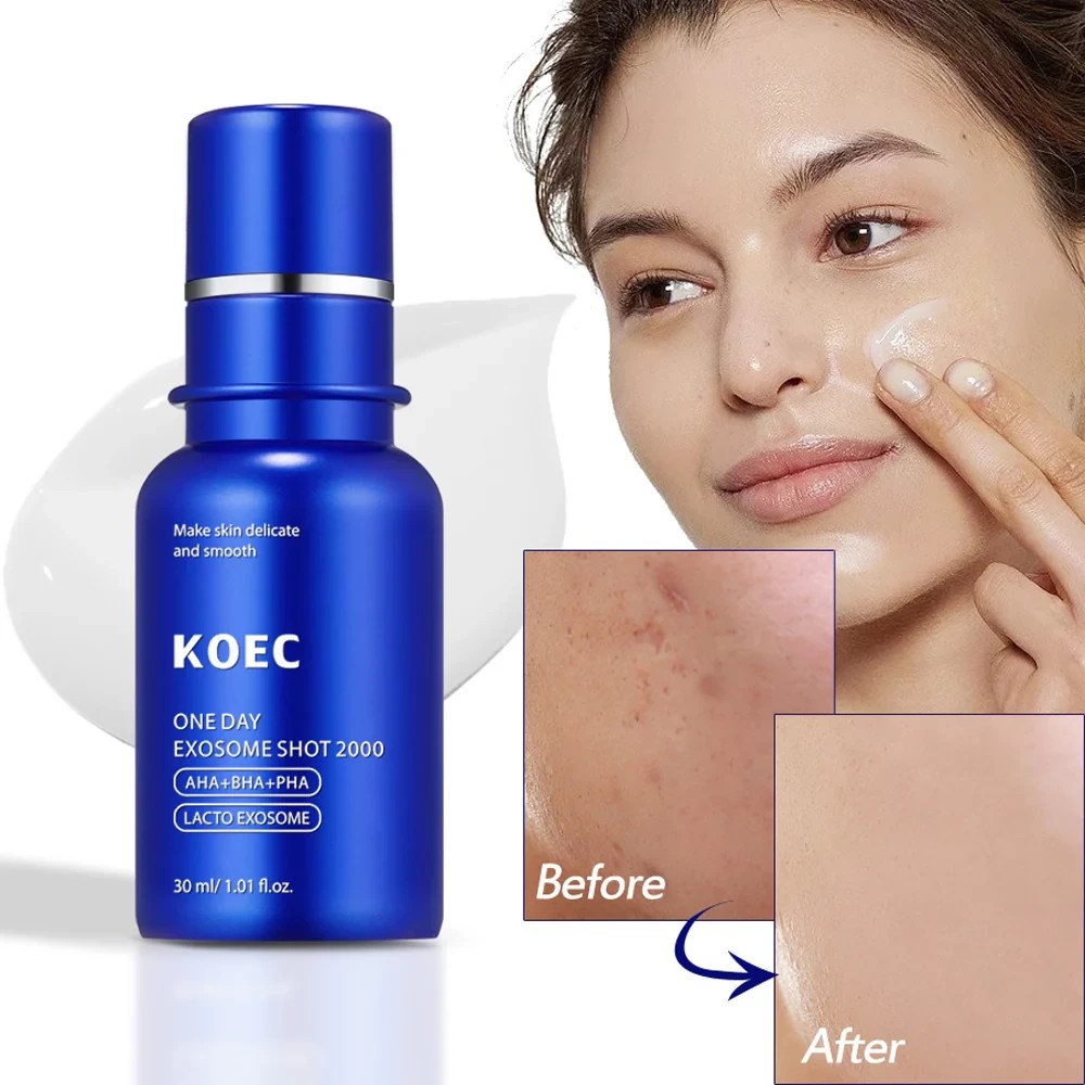 KOEC ONE DAY EXOSOME SHOT 2000 Face Serum