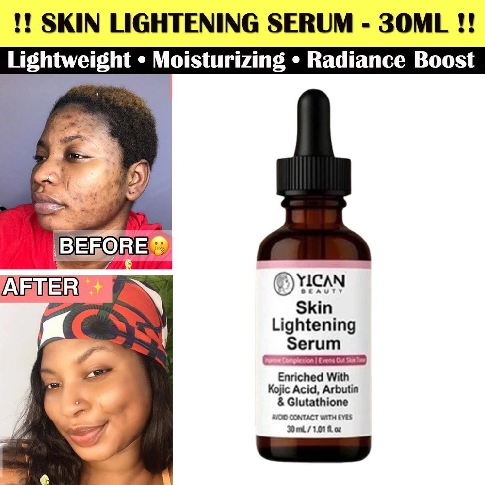 Kojic Skin Lightening Serum Face Body Anti-Dark Spots Essence, 30ml