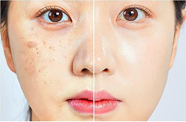 (85%) Human Stem Cell & (10%) PDRN Anti-Aging & Repair Ampoule Serum (12 Vial…