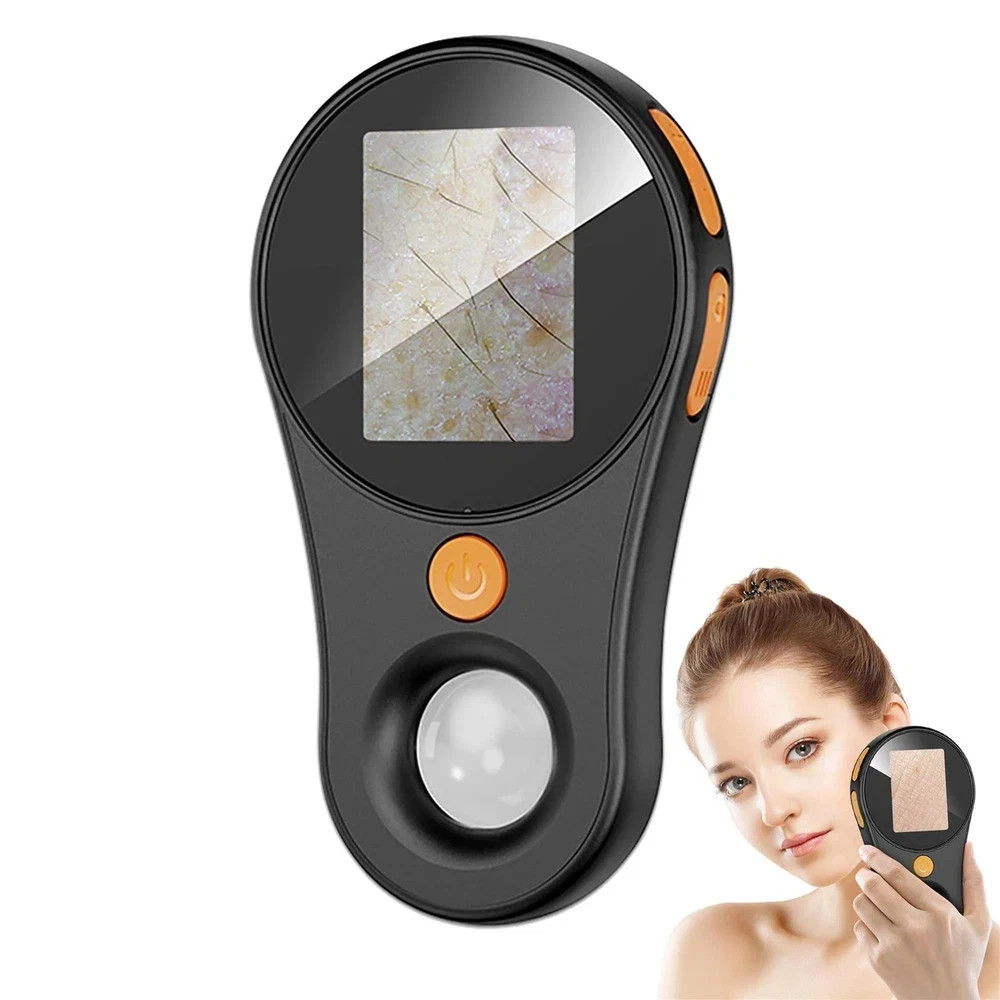 Handheld Dermatoscope Skin Analyzer Machine, Wireless Portable Digital Micros…