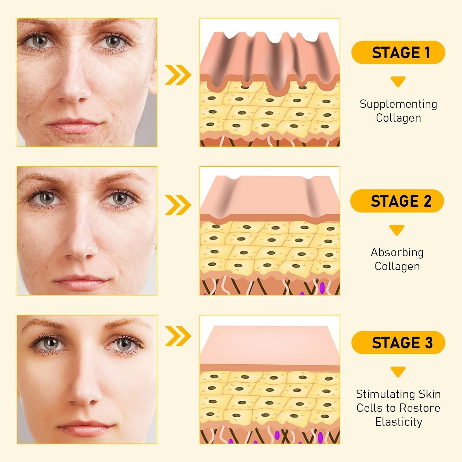 Bee Venom Skin Restoration Cream, Professional Bee Venom Skin Cream,deeply …..