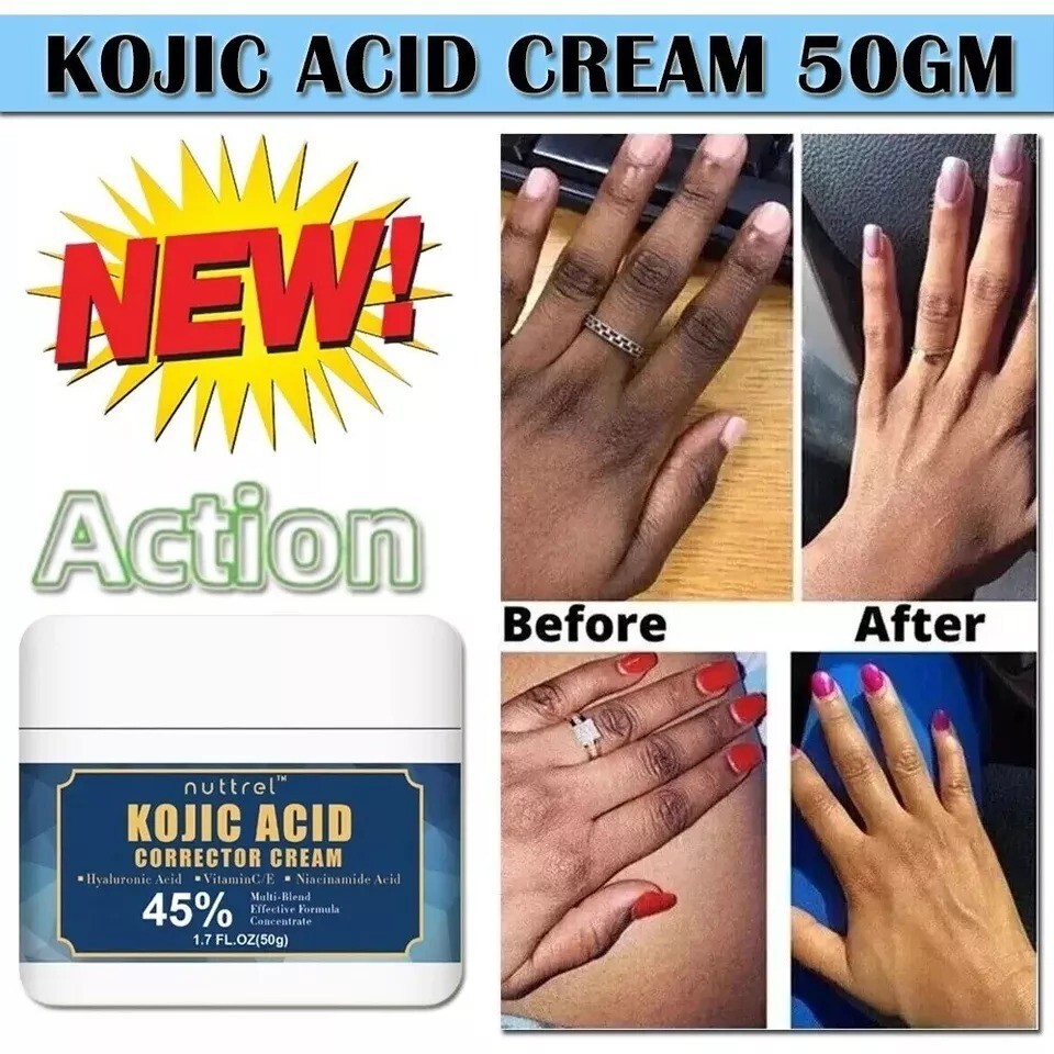Dark Spot Corrector Face, Hands, Neck. Skin Dark Spot Remover Cream 1.7 fl oz