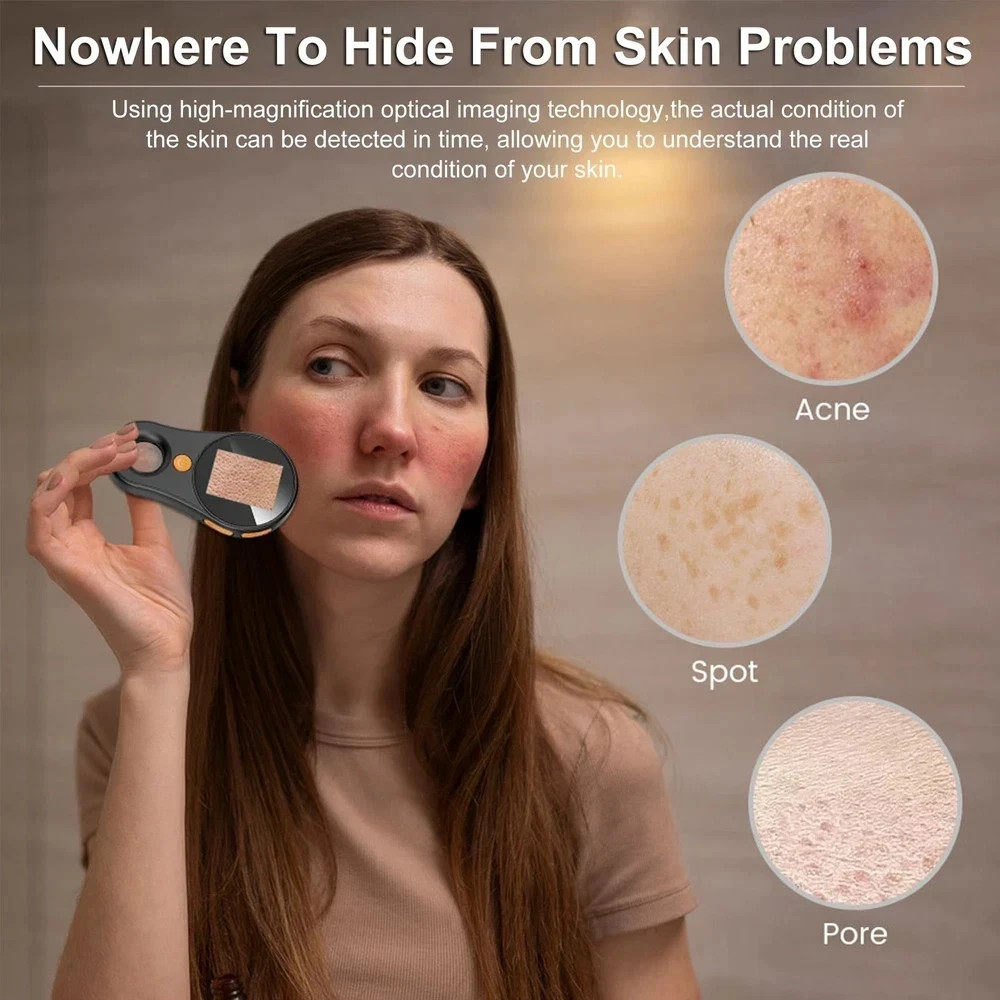 Handheld Dermatoscope Skin Analyzer Machine, Wireless Portable Digital Micros…