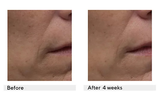 Dr. Denese 100-count Advanced Firming Facial Pads