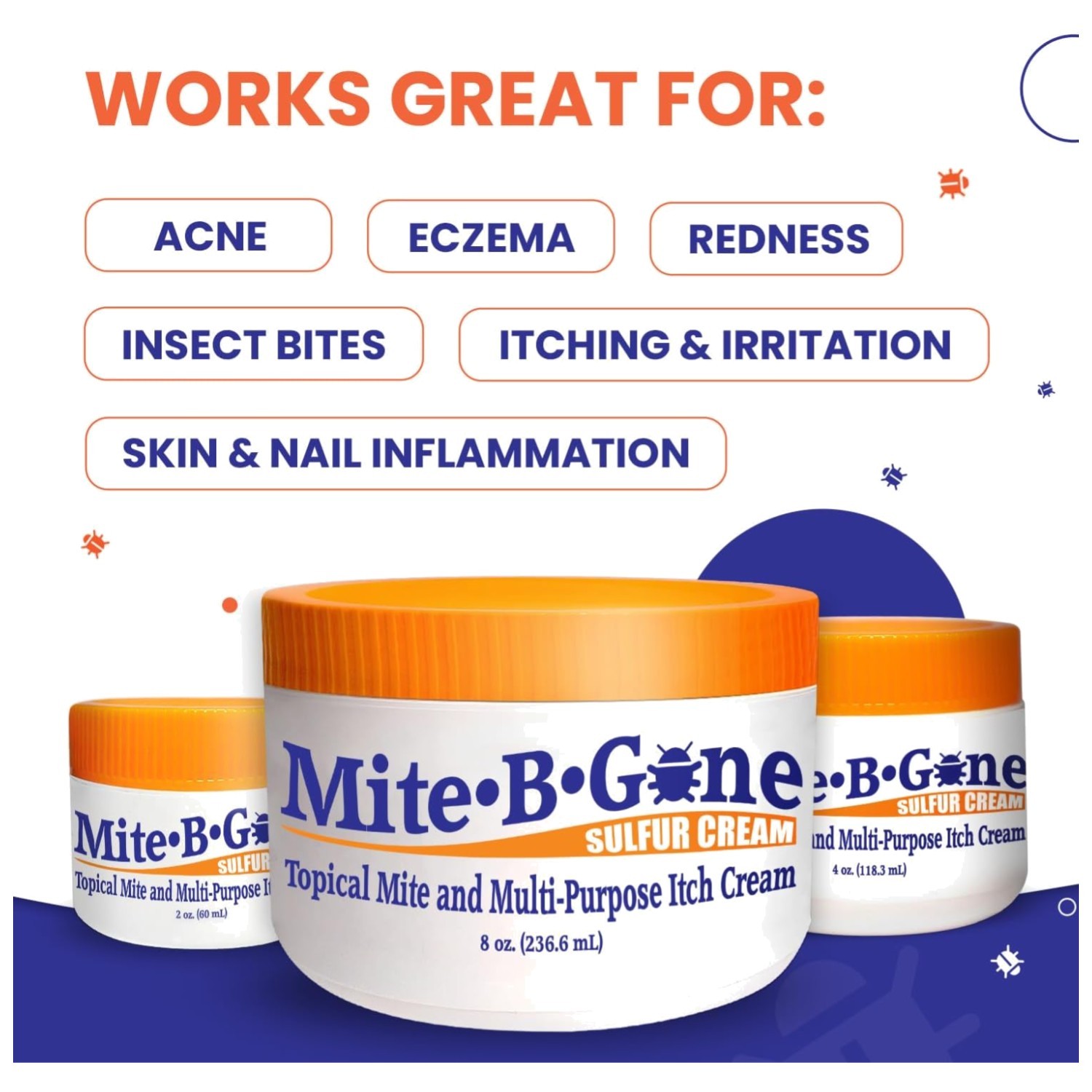 Sulfur Cream for Skin Itching – Child & Adult Safe