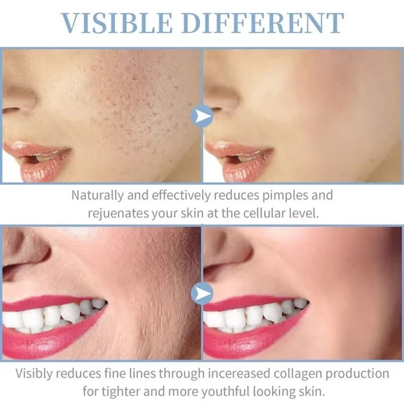 High Frequency Facial Skin Care Wand Machine Anti-aging Acne Hair Treatment Set
