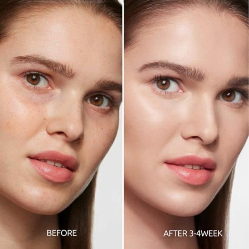 Dark Spot Remover for Face and Body – Dark Spot Corrector Serum for Face – Sun S