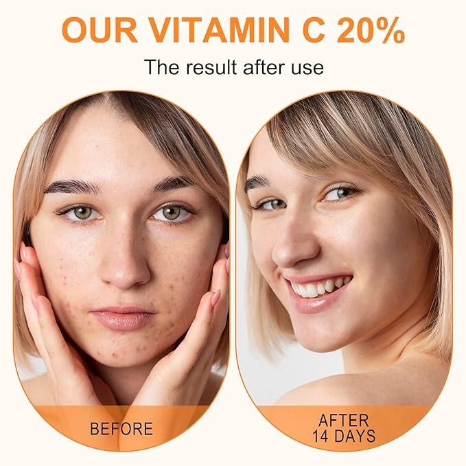 Premium 20% Vitamin C Serum For Face with Hyaluronic Acid, 60 ml