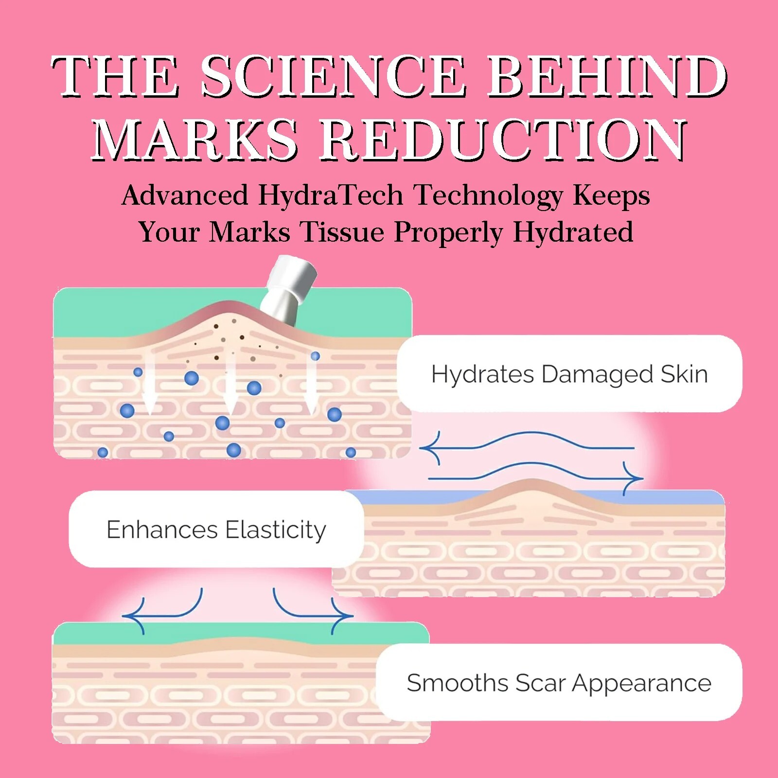 AILKE Natural and Organic Marks Clearing Cream to Reduce the Appearance of Marks