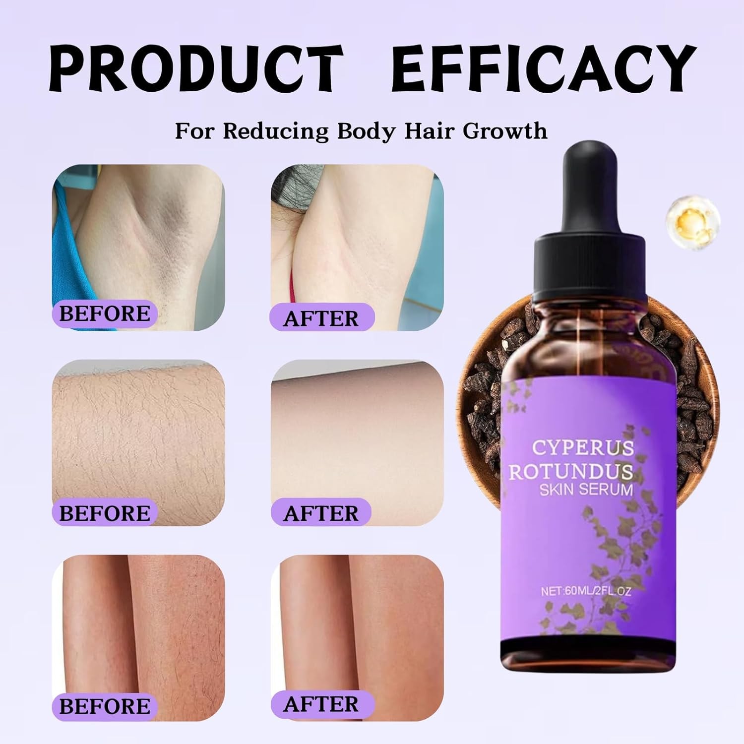 2PCS Cyperus Rotundus Skin Serum, Cyperus Rotundus Oil，Hair Removal Repair Ess
