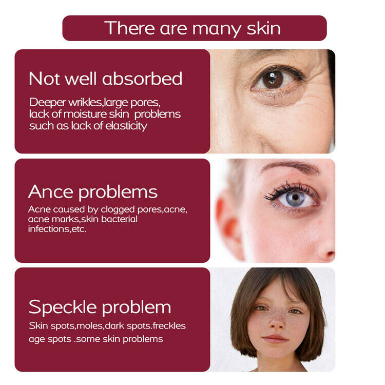 6Pcs/Set Replace Accessory for Mole Removal Plasma Pen Freckle Dark Spot Remover