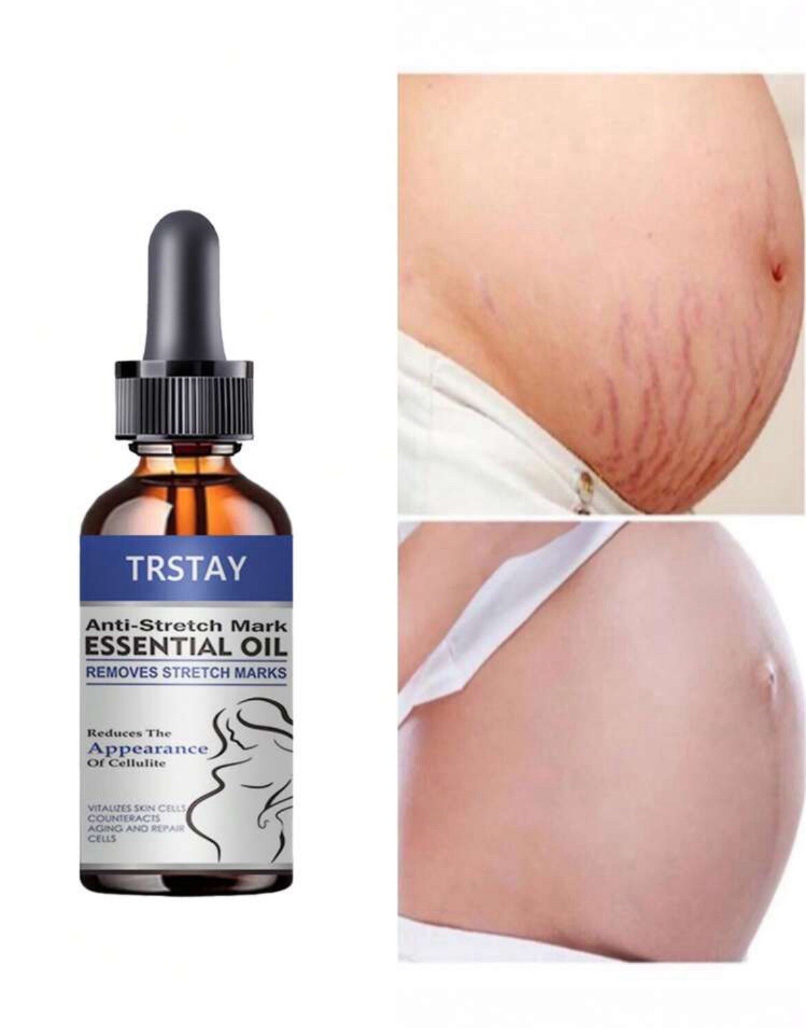 stretch marks Moisturize, Smooth, Firm, Repair