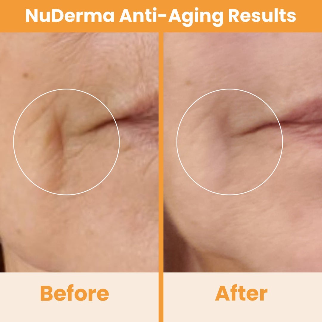 NuDerma Standard High Frequency System. Pure Daily Care
