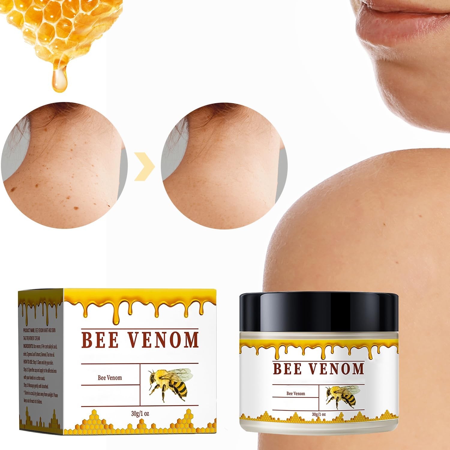 3 Bee Venom Skin Restoration Cream, Professional Bee Venom Skin Treatment Cream