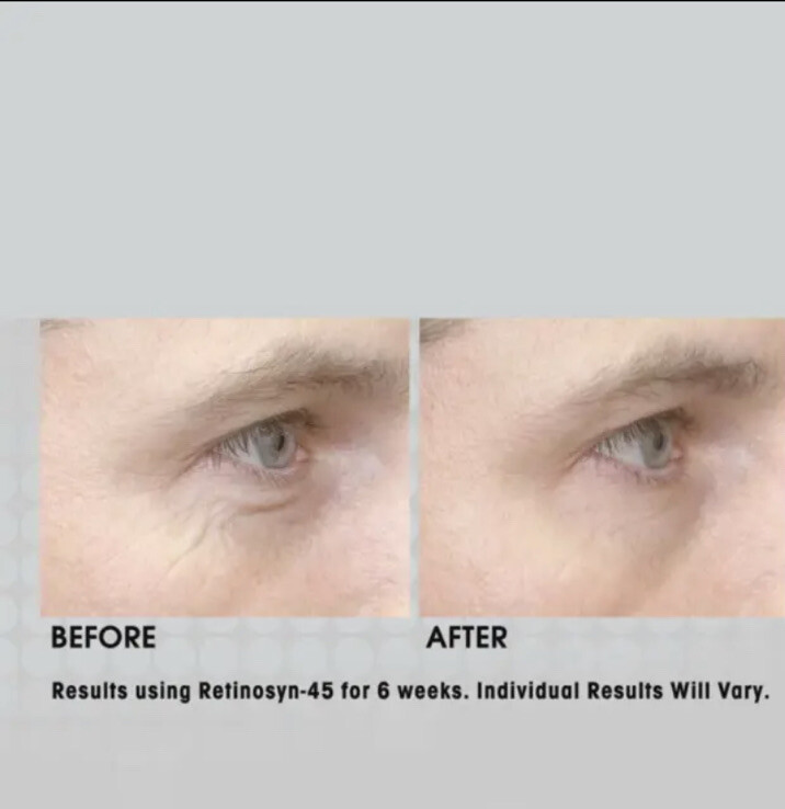 BEAUTY BIOSCIENCE R45 The Reversal 3-Phase Retinol System Large 3pc Gift Set New