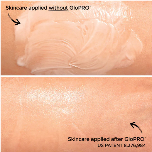 GloPro Pack N’Glo Complete Glo Microneedling Set from BeautyBio NIB Skincare