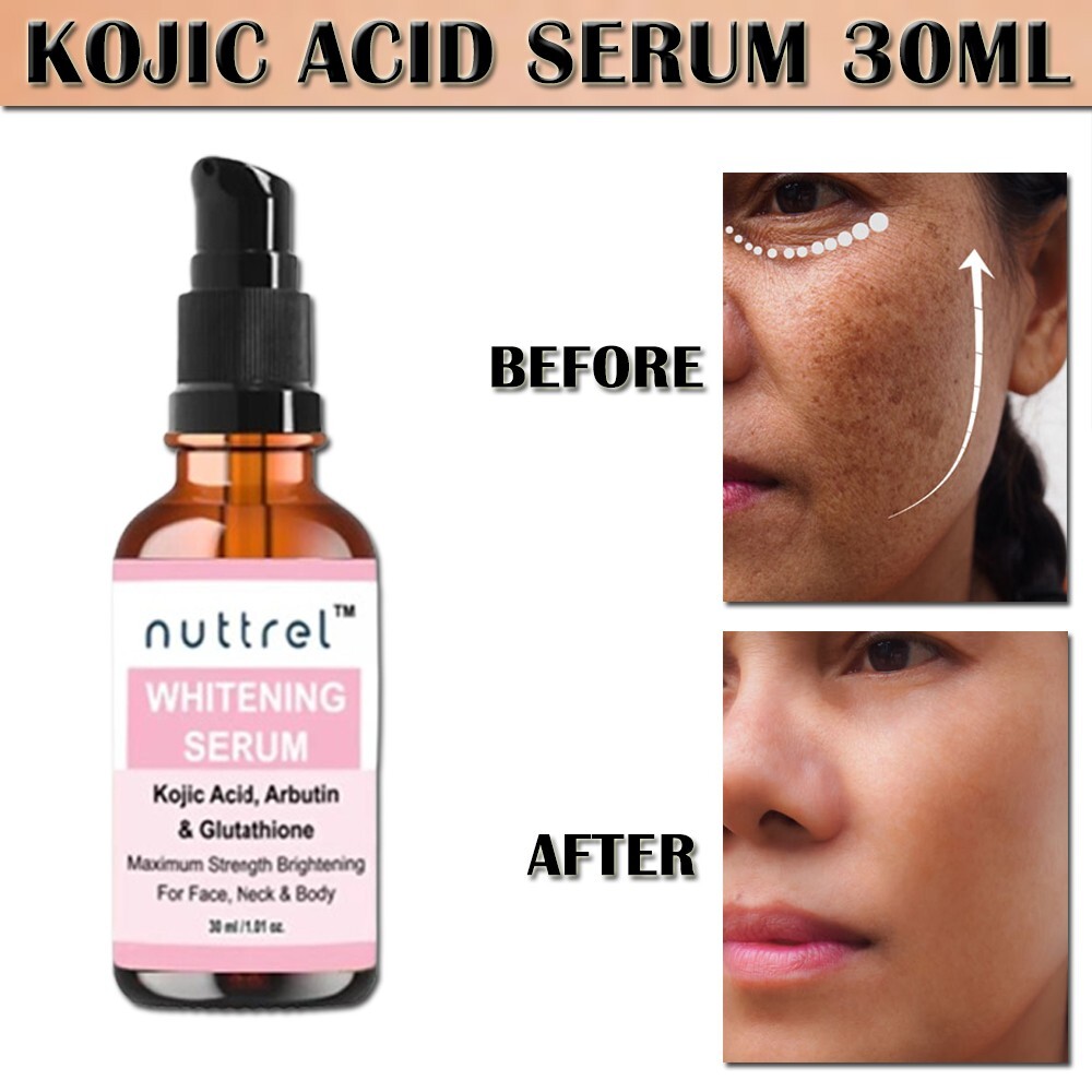 5% Kojic Acid Serum For Glossy Glow Skin With 1% Alpha Arbutin Serum