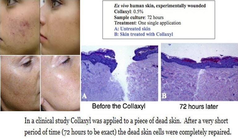 COLLAXYL® PEPTIDE COLLAGEN BOOSTER ACTIVE HEXAPEPTIDE-9