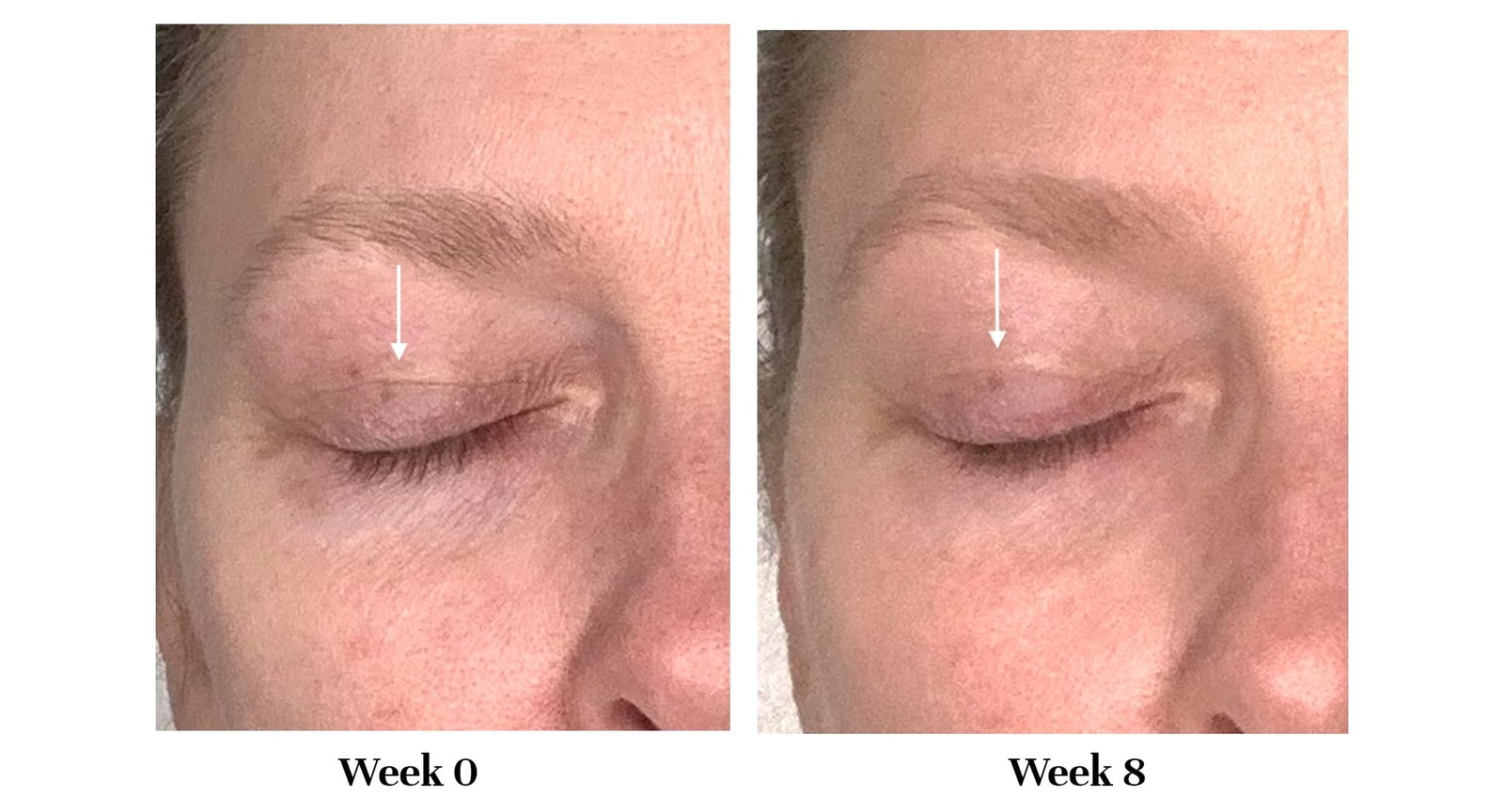 City Beauty Lid Lifting Formula – Eye Cream for Aging Eyelids – Inst