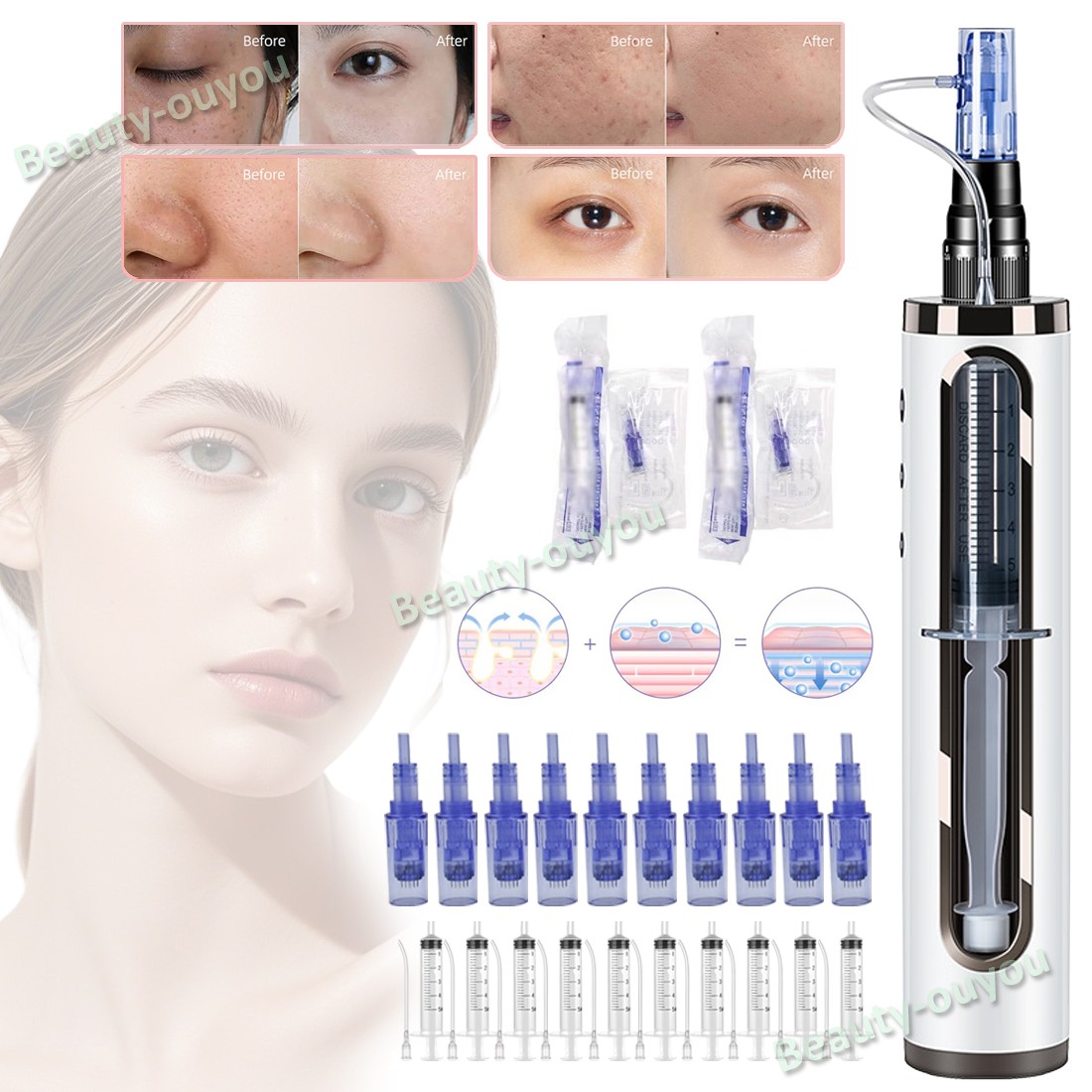 Micro Pen Mesotherapy & 10Pcs 3D Pin Replacement Needle Cartridge Tips Face Care